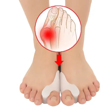 Sdatter 2 buc=1Pair Silicon de la Picioare Separator de Inflamație la picior Os Ectropion de Reglare de la Picioare Exterioare Aparat Picior de Îngrijire Instrumente Hallux Valgus Cor
