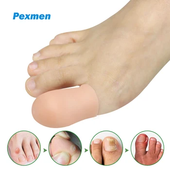 Pexmen 2 buc/Punga Gel Moale Degetul Mare capace Capace de Prevenire pentru Vezicule si Bataturi Unghiile Incarnate Picior Durerii Protector